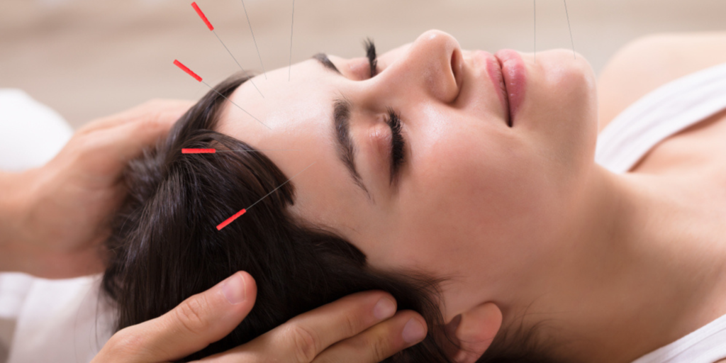 Facial Rejuvenation Acupuncture