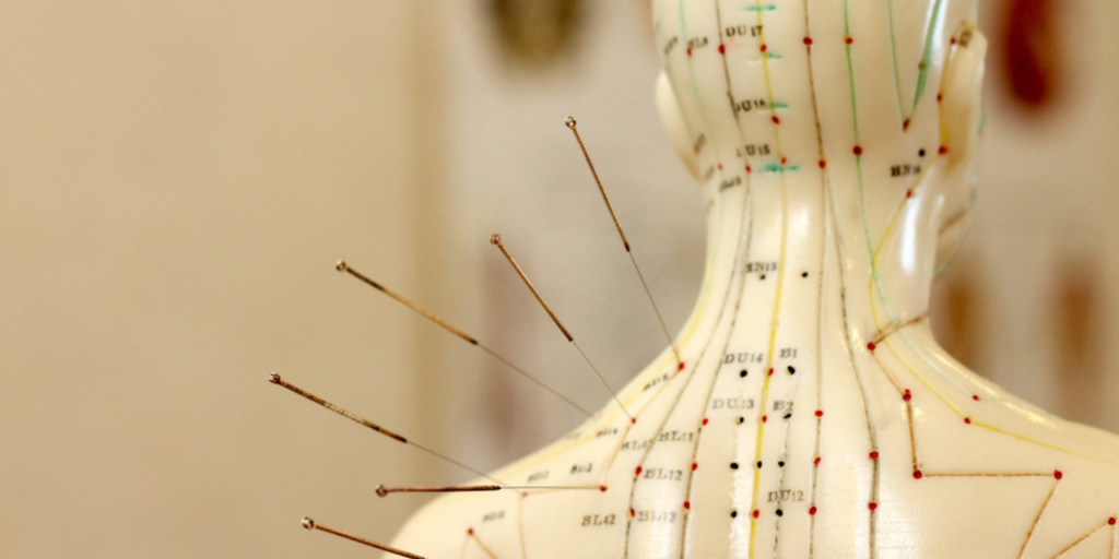 History Of Acupuncture: 5 Millennia of Healing