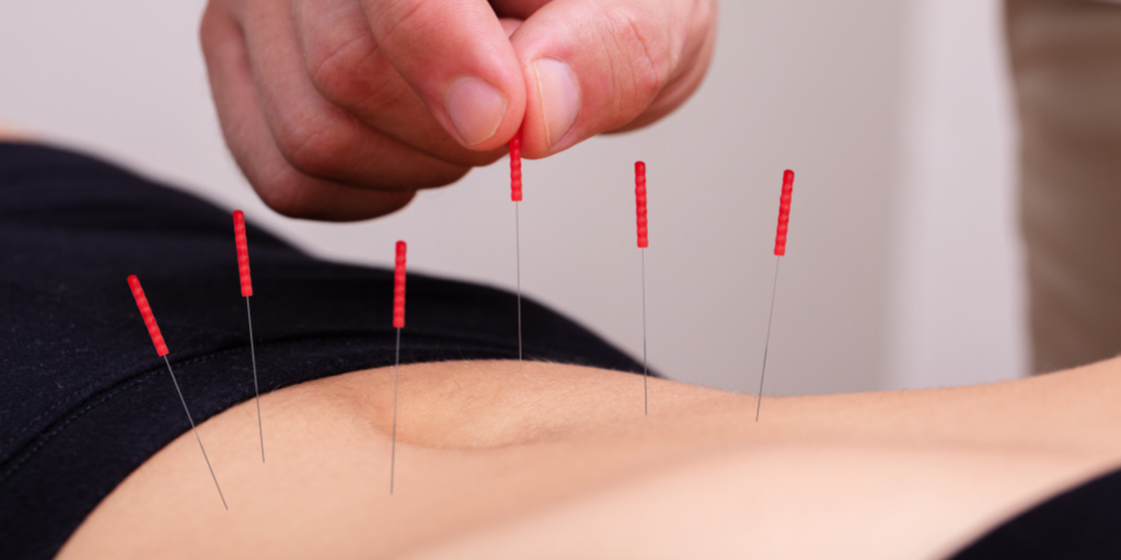 Acupuncture Boosts Women's Health