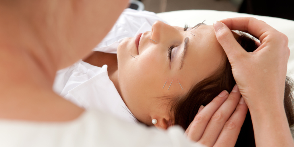 Facial Rejuvenation Acupuncture